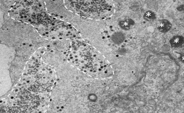 DESCUBREN EN BRASIL EL YARAVIRUS